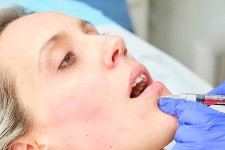 Woman receiving lip augmentation with botulinum toxin injection.